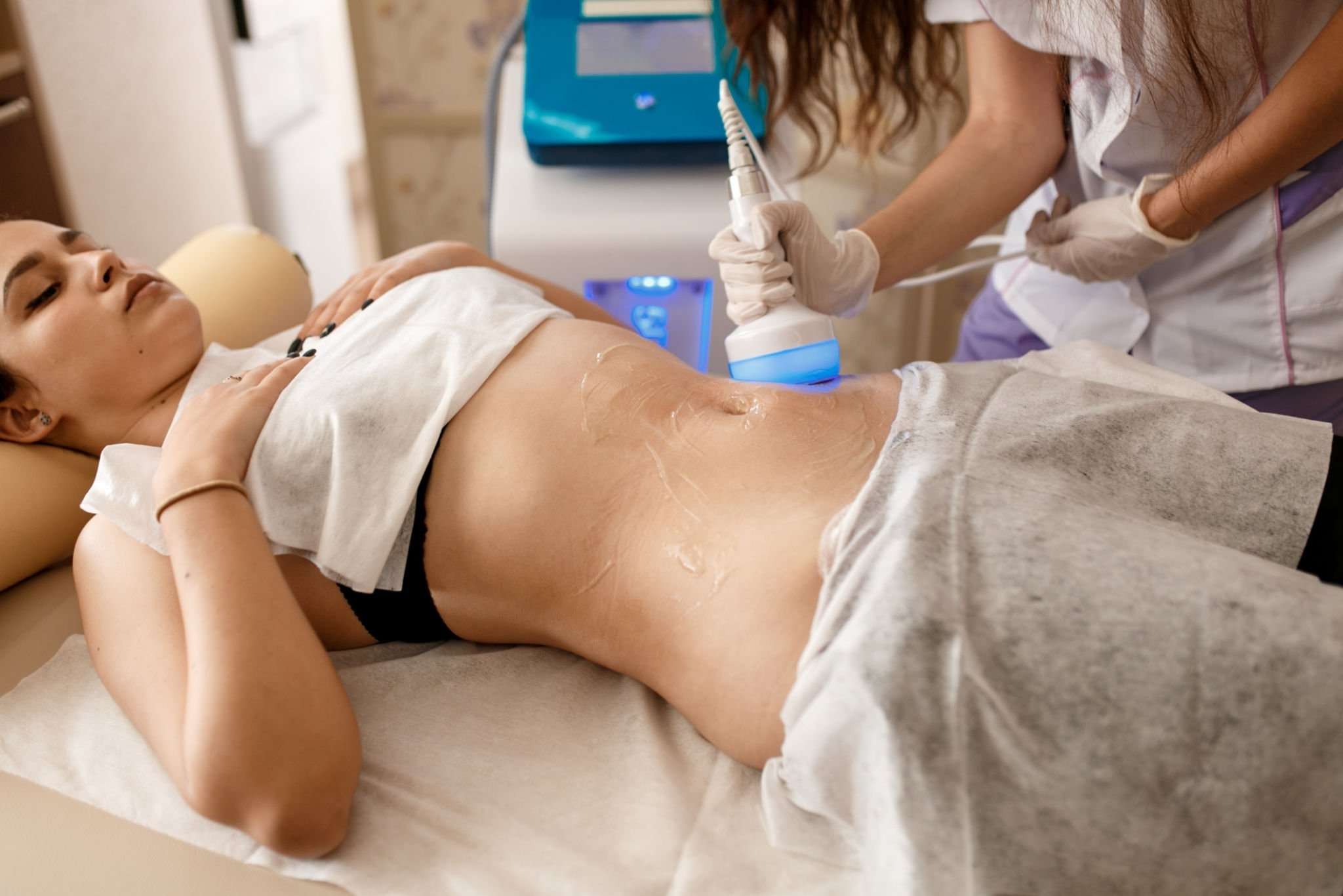 Liposuction