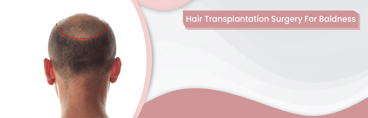 hair_trans