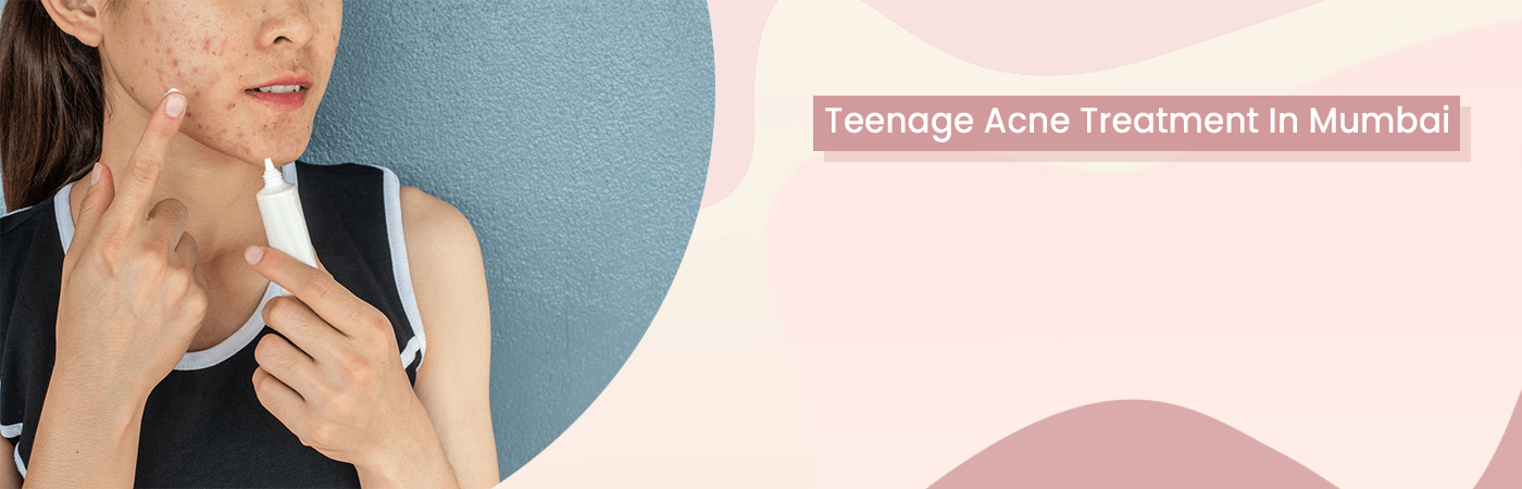 Best Acne Face Wash for Boys: Top Teen Picks for Clear Skin