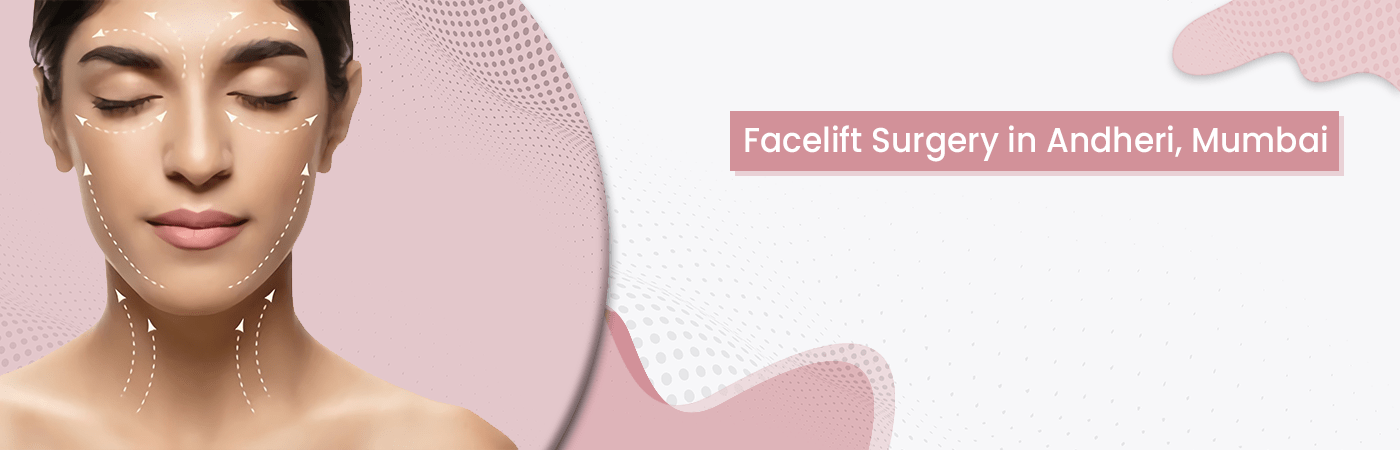 Facelift surgery