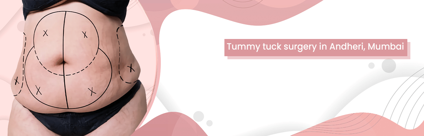 Tummy tuck surgery