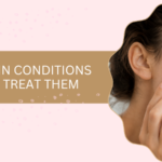 Common Skin Conditions and How to Treat Them