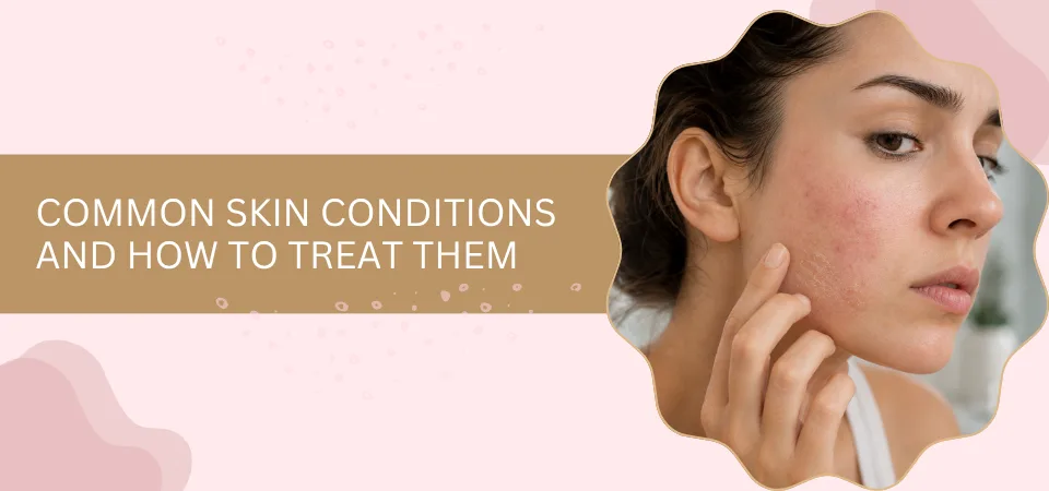 Common Skin Conditions and How to Treat Them