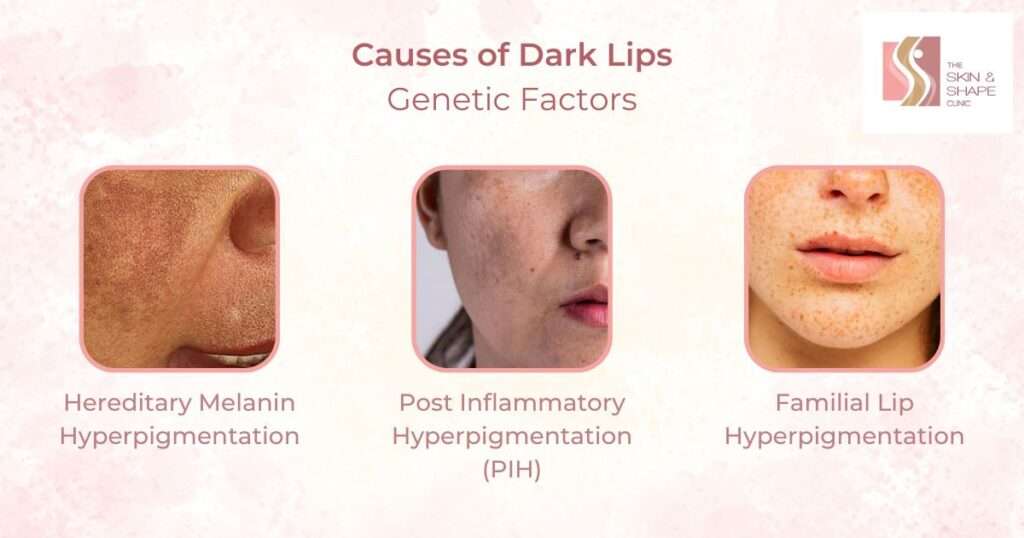 Genetic Factors that causes Dark Lips