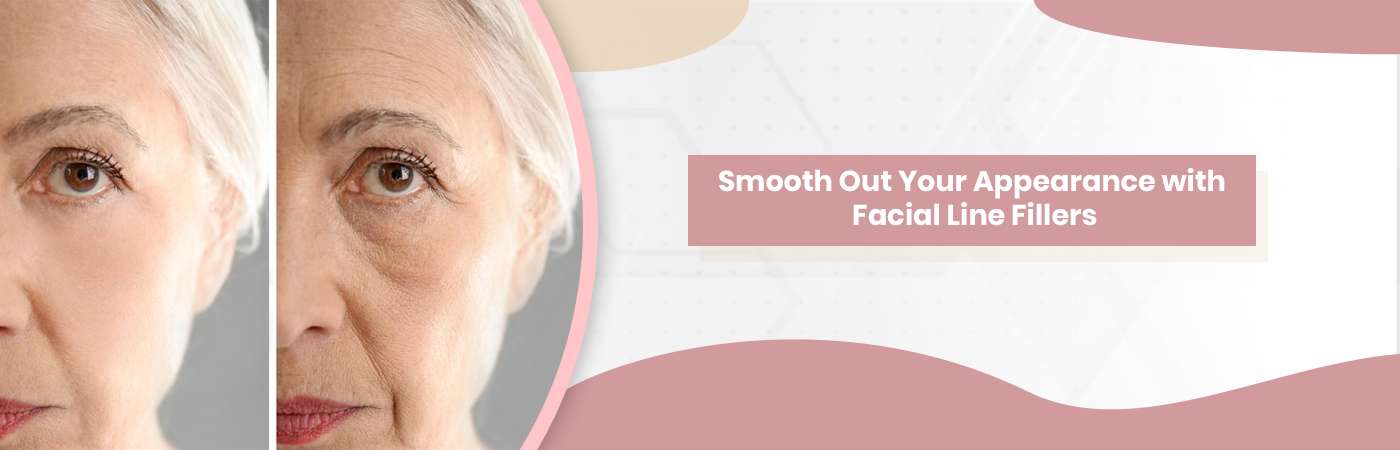 Smooth Out Your Appearance with Facial Line Fillers