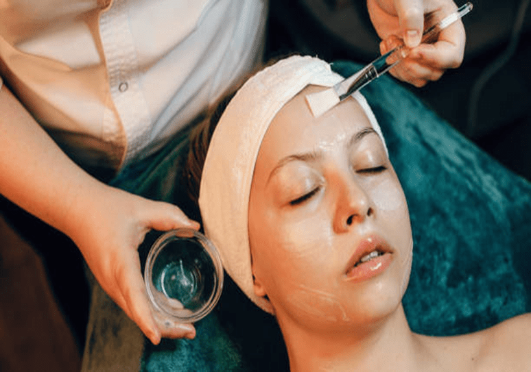 Chemical Peels for pigmentation on forehead