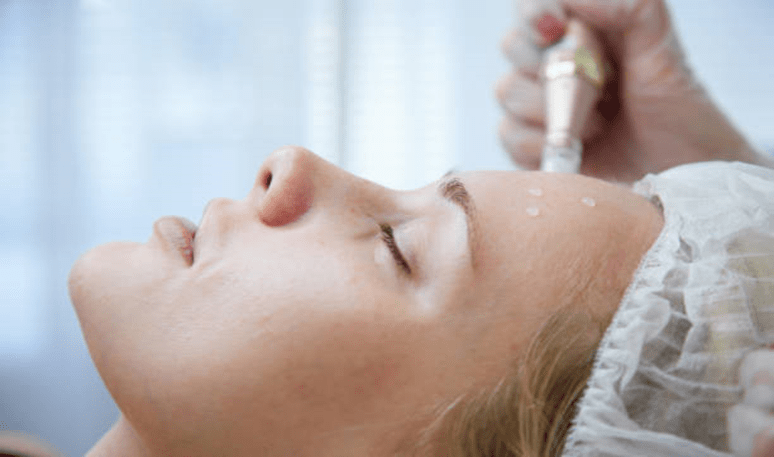 Topical creams & serums for pigmentation on forehead