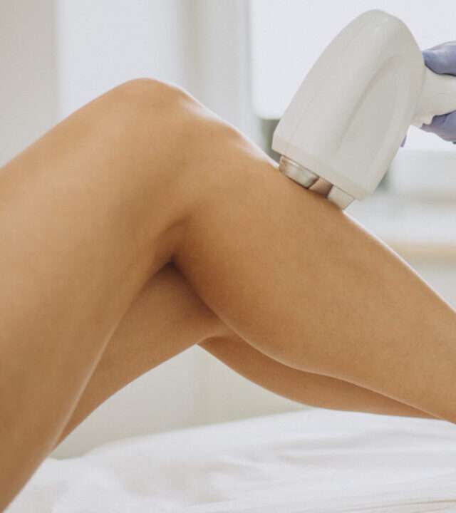 laser hair removal sessions