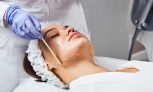 Overview of Chemical Peels and their Popularity in Mumbai
