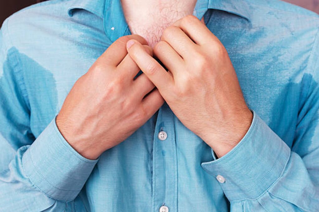 what is excessive body sweating?