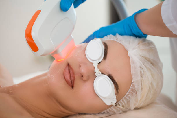 what is laser treatment for pigmentation