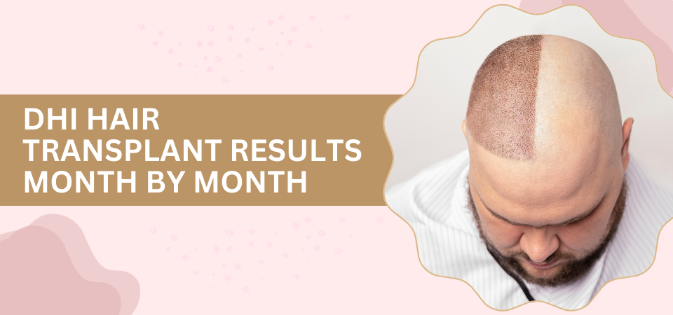 DHI Hair Transplant Results Month By Month