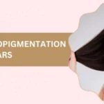 Promotional banner about scalp micropigmentation results after 10 years, featuring a smiling woman with long hair on the right.