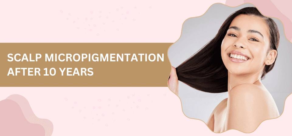 Promotional banner about scalp micropigmentation results after 10 years, featuring a smiling woman with long hair on the right.