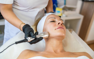 Microneedling_with_Radiofrequency_(RF)