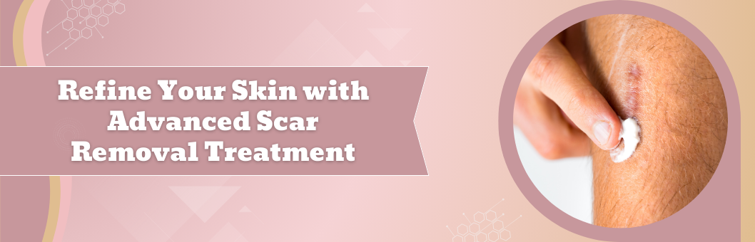 Refine_Your_Skin_with_Advanced_Scar_Removal_Treatment
