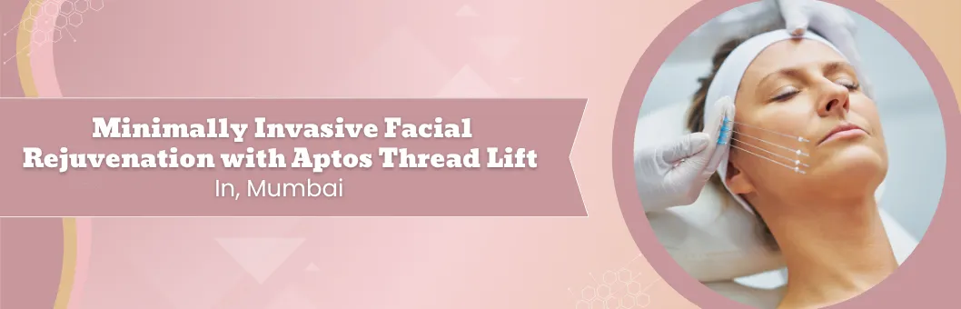 Minimally_Invasive_Facial_Rejuvenation_with_Aptos_Thread_Lift