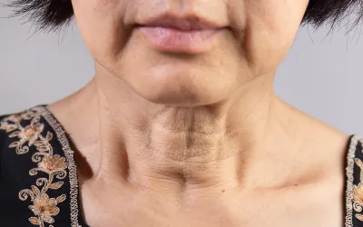 Sagging_jowls_and_jawline