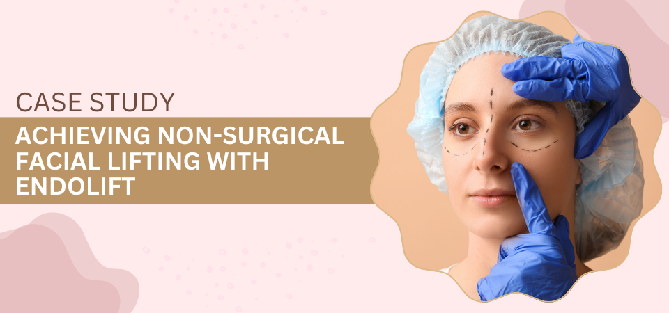 Achieving Non-Surgical Facial Lifting with Endolift