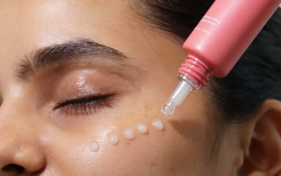 Microneedling with Depigmenting Serums