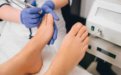 Advanced_Nail_Fungus_Management