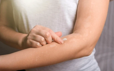 Topical_Antifungal_Drugs