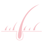 Thinning Hair in Women