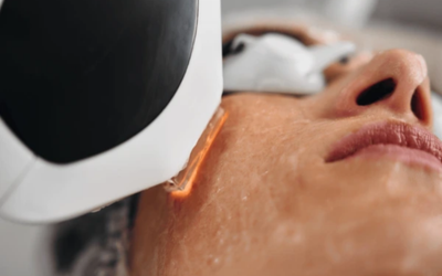 Laser and Light Therapy