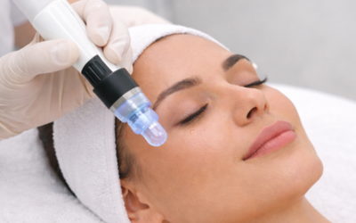 Salmon Sperm Microneedling (1)