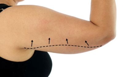 Post-Treatment Care Guidance