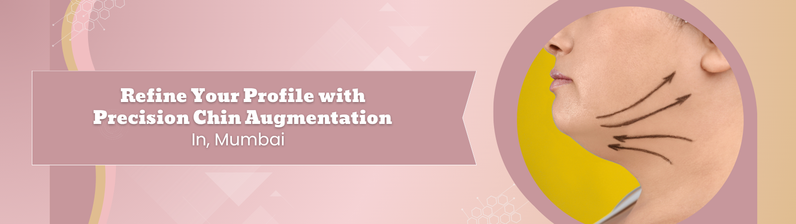 Refine Your Profile with Precision Chin Augmentation