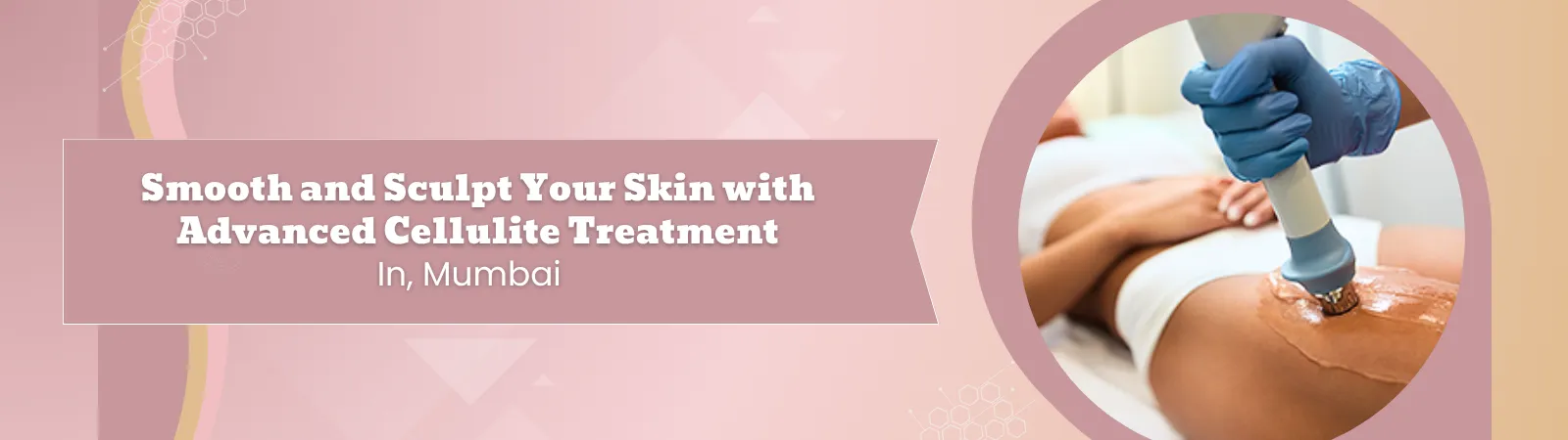 Smooth and Sculpt Your Skin with Advanced Cellulite Treatment
