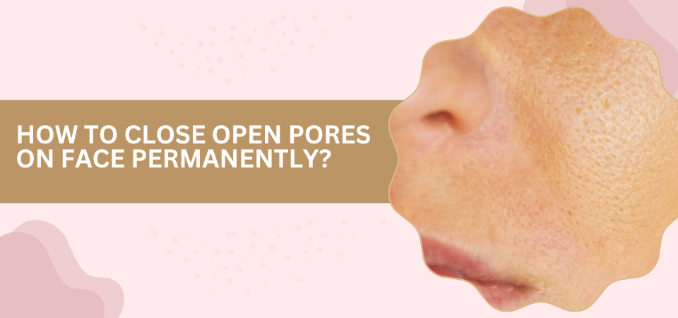 Banner about closing open facial pores; close-up of a nose with visible pores on a pink background and a tan text band reading 'How to close open pores on face permanently?'