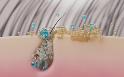 Close-up of a hair follicle on skin with sebum, soap bubbles, and small blue droplets.