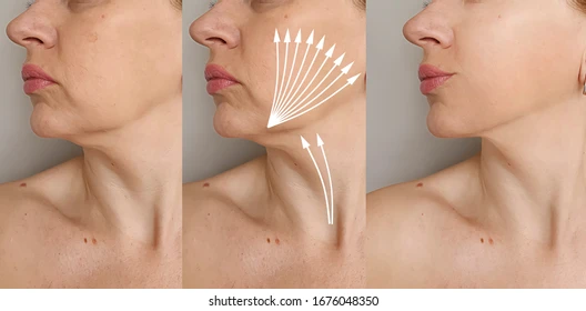 Three-panel sequence of a woman's side face showing a facial massage technique; white arrows indicate upward strokes along the jawline and neck for lifting.
