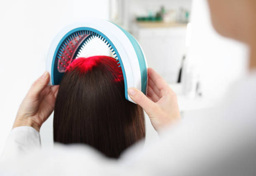 Person wearing a blue hair treatment helmet being applied to their head by a clinician or stylist.