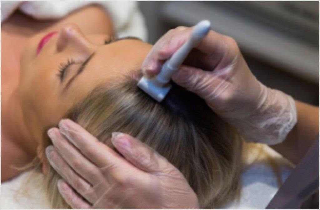 Gloved technician uses a handheld device on a woman's scalp during a treatment.