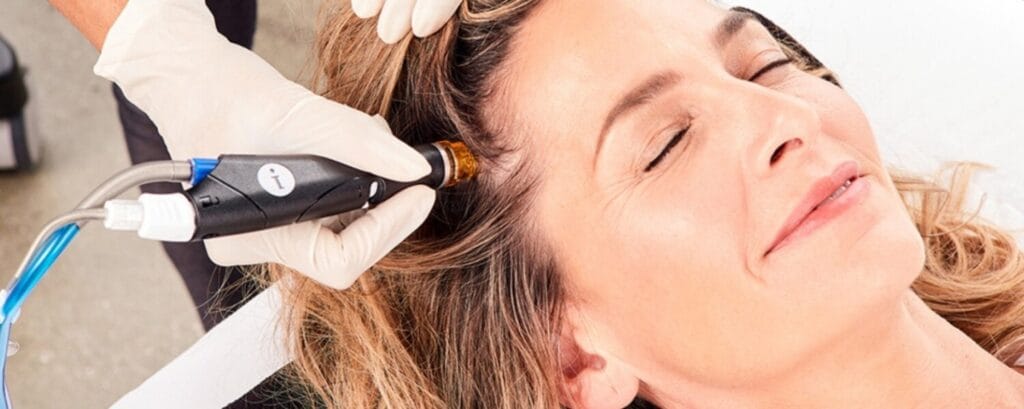 sclap1 Woman relaxing as a clinician uses a handheld device on her temple during a cosmetic procedure.