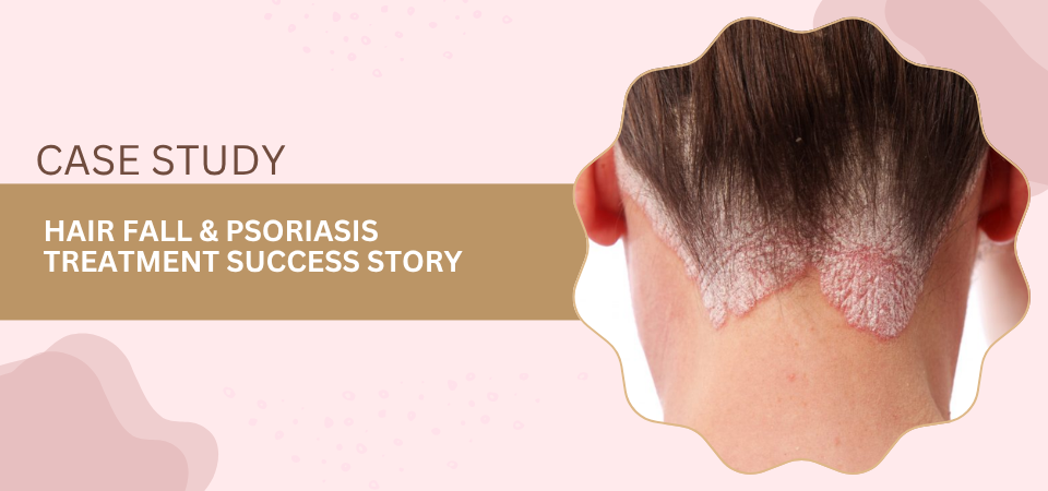 Close-up of the back of a person’s neck with psoriasis along the hairline, beside a banner that says 'CASE STUDY: HAIR FALL & PSORIASIS TREATMENT SUCCESS STORY'
