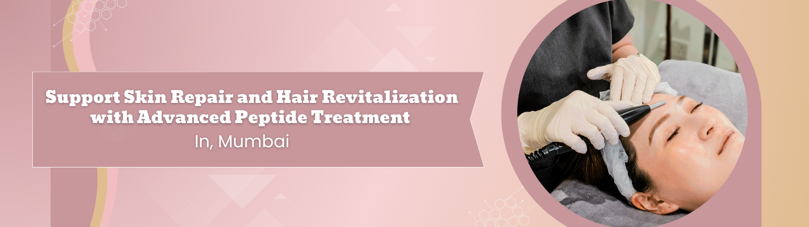 Maximizing Hair Restoration Results with Growth Factors Concentrate (GFC) Treatment