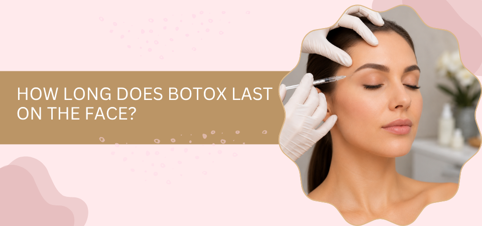 How Long Does Botox Last on the Face