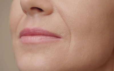 Close-up of a woman's mouth and lower cheek showing fine wrinkles around the lips.