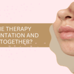 Can Exosome Therapy Treat Pigmentation and Acne Scars Together