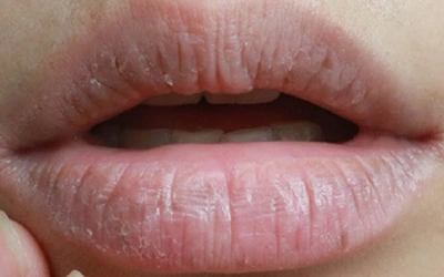 Close-up of a person's lips, slightly parted.