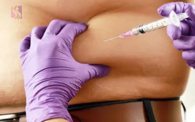 Close-up of a clinician in purple gloves administering an injection into a person’s side torso.