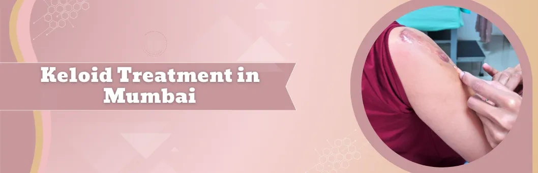 Keloid Treatment in Mumbai