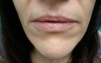 Close-up of a person's lower face showing lips and chin with slight fine lines and pale pink lips.