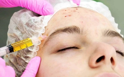 â___Post-Procedure Regenerative Support Close-up of a patient receiving a forehead injection; clinician in pink gloves administers a syringe while the patient lies with eyes closed.