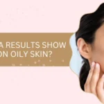 Do Sculptra Results Show Up Slower on Oily Skin