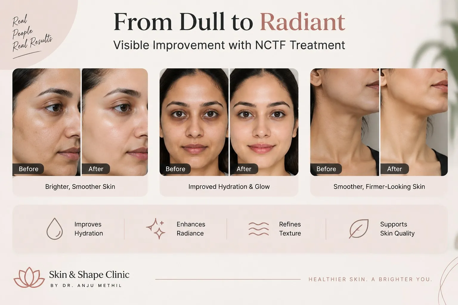 H2 Benefits of NCTF Treatment at Skin _ Shape Clinic